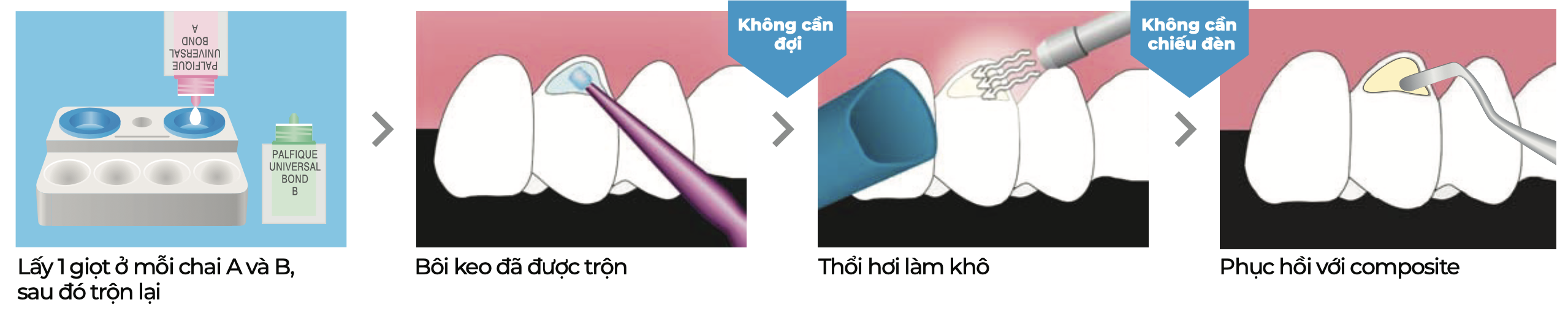 Keo dán đa năng Palfique Universal Bond Kit - Tokuyama